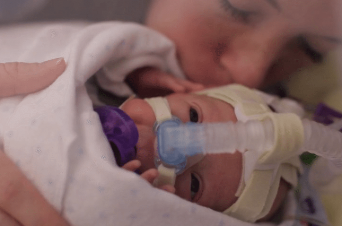 Neverovatna priča o prvoj godini života prevremeno rođene bebe (VIDEO)