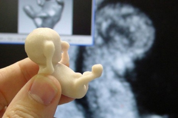 Odštampajte svoju buduću bebu pomoću 3D štampača!