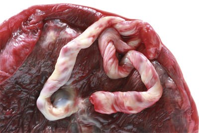 placenta posteljica