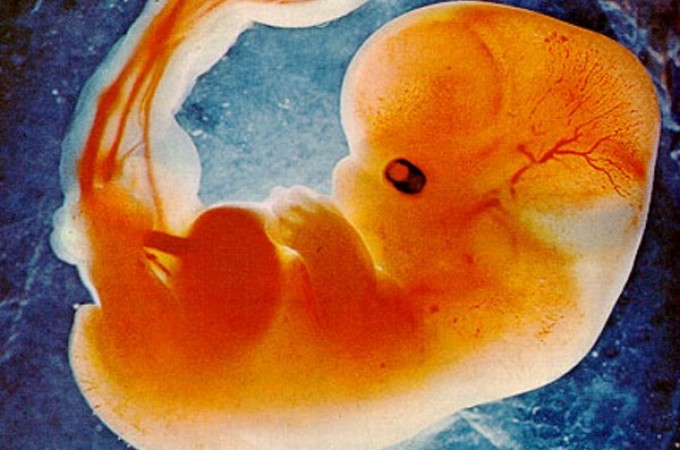 Zašto sam prestao da vršim abortuse? (dr Stojan Adašević)