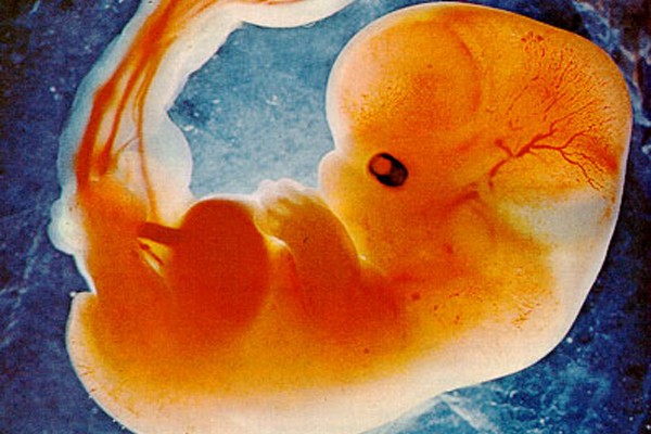 zasto sam prestao da vrsim abortuse