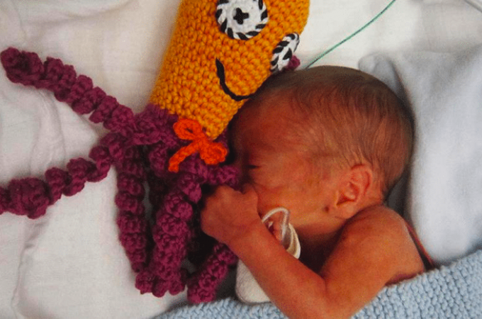 Hobotnice čudesnice pomažu prevremeno rođenim bebama