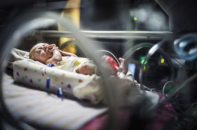 Urođene anomalije novorođenčadi mogu se uspešno lečiti