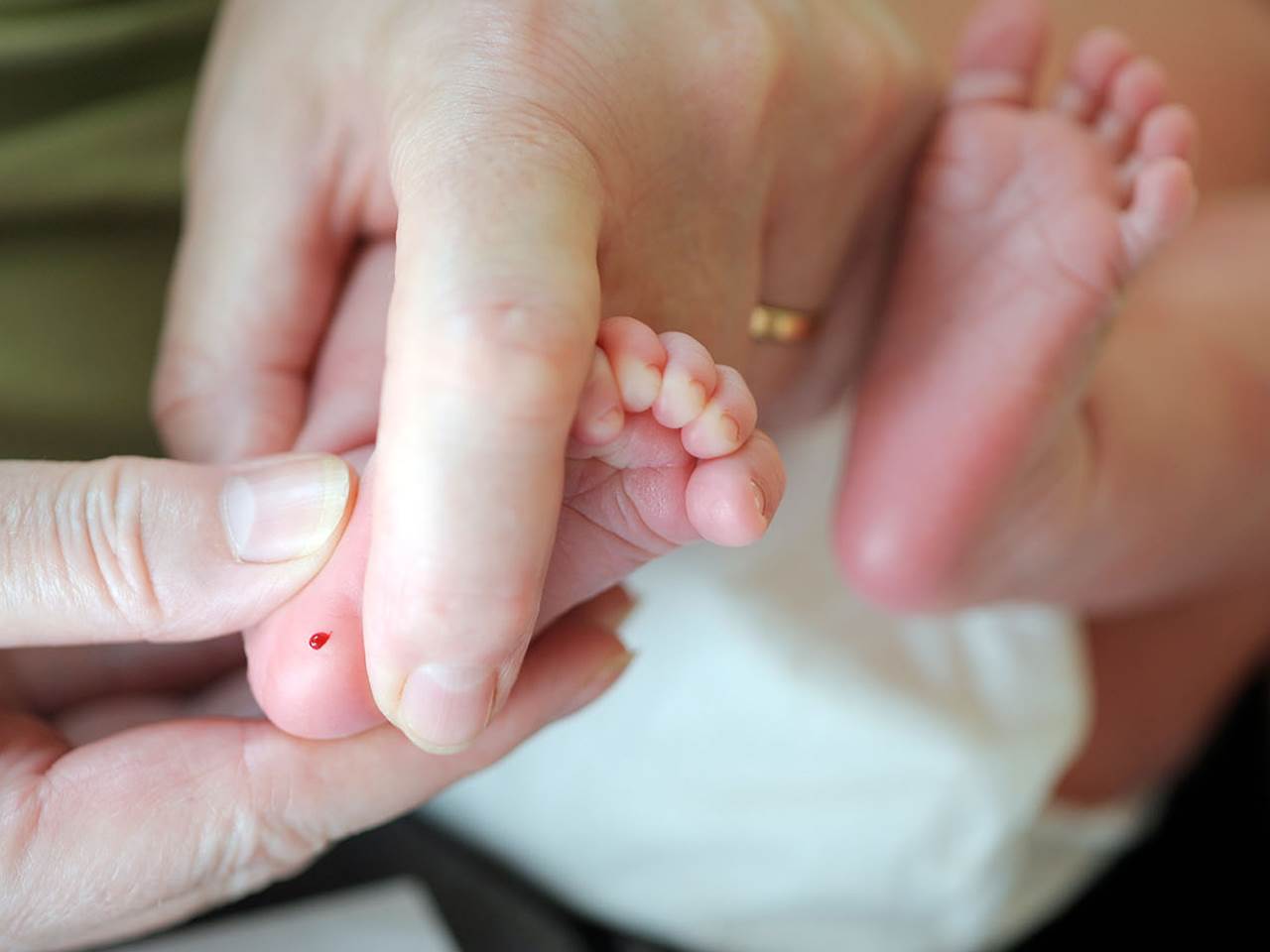 Otkrivanje urodjenih bolesti iz kapi krvi bebe