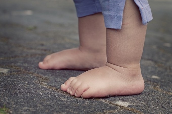 Ortoped sa Banjice otkrio istinu o preskupoj dečijoj obući: Anatomske cipelice sa “uloškom” izazivaju ravna stopala