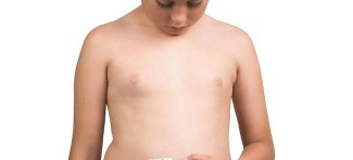 Gojaznost sve veći problem – kako sačuvati decu?