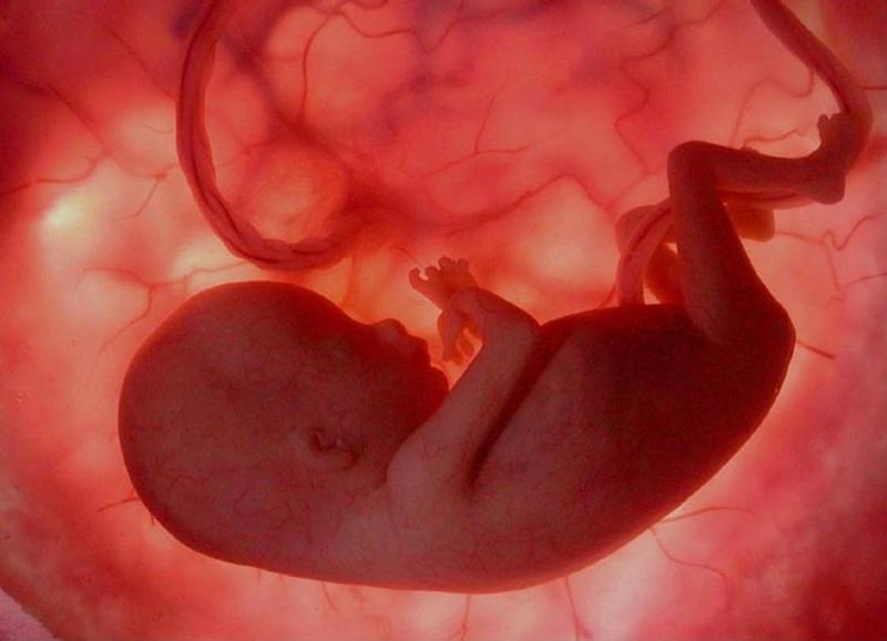 fetus