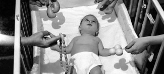 Preterana stimulacija kao uzrok plača bebe