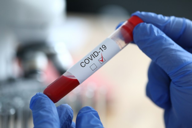 covid test