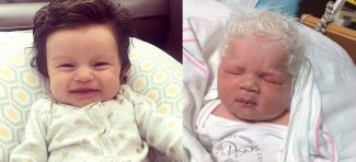 Roditelji dele fotografije svojih beba sa neverovatnom kosom