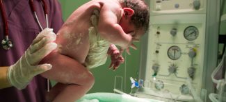 Epiduralna anestezija tokom porođaja: da li je ovo dobra odluka?