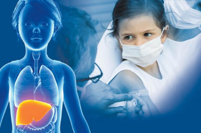 „Misterioznim hepatitisom“ zaraženo 228 dece u svetu